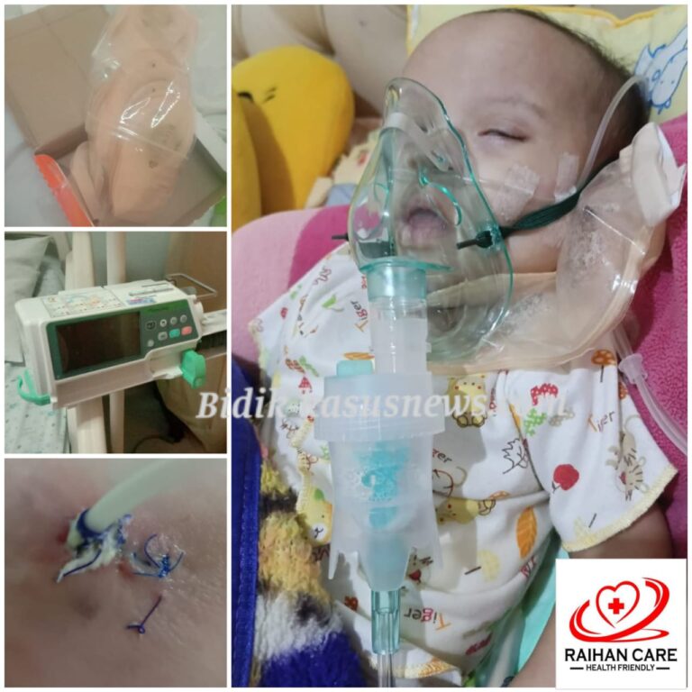 Yayasan Raihan Care Galang Donasi untuk Nawal, Bayi 7 Bulan di Depok yang Derita Atresia Esofagus, Jantung Bocor, dan Down Syndrome