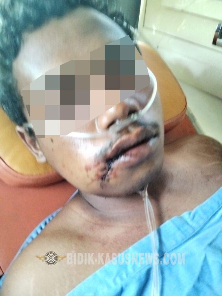 Niat Menjemput Teman yang Tertinggal, Seorang Pelajar di Amuntai Utara Bersimbah Darah Usai Dikeroyok Sekelompok Pemuda
