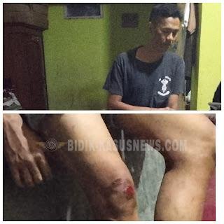 Rusaknya Jalan dan Ketiadaan Penerangan Jalan Menjadi Penyebab Kecelakaan Lalu Lintas di Jembatan Tol Arah Astapada